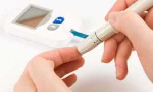 Сахарный диабет: как распознать симптомы у взрослых и детей