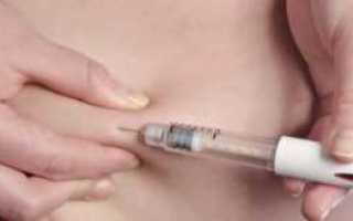 Что такое стероидный сахарный диабет