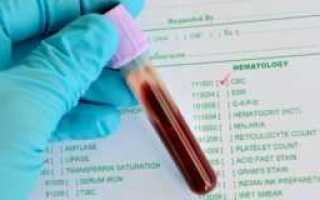 Откуда производят забор крови для анализа на сахар