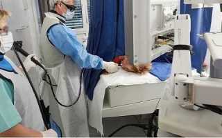 Что такое эндоскопическая ретроградная холангиопанкреатография?