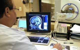 Что покажет магнитно-резонансная томография головы?