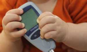 Признаки сахарного диабета у новорожденных – это нужно знать