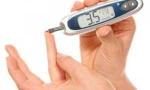 Сахарный диабет — как можно снизить сахар быстро и без лекарств?