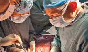 Последствия, прогноз здоровья и жизни после операции на поджелудочной железе