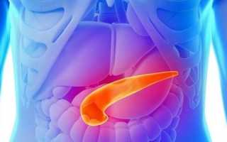 Причины, симптомы и лечение стеатоза в поджелудочной железе