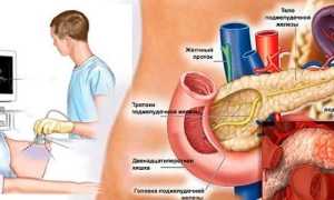 Причины увеличенного лимфоузла поджелудочной железы