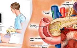 Причины увеличенного лимфоузла поджелудочной железы