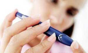 Декомпенсация сахарного диабета: основные понятия