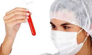 Подробно о признаках преддиабета и что делать для его излечения