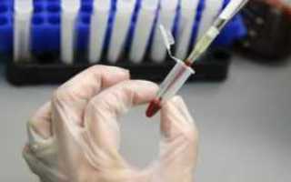 Нормальные значения глюкозы и холестерина в крови