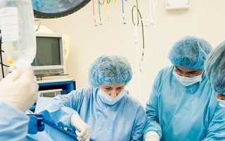 Виды, процесс и показания к операции на поджелудочной железе при различных патологиях