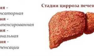 Диагностика цирроза печени