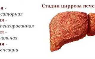 Диагностика цирроза печени