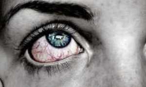 Что такое ретинопатия при сахарном диабете