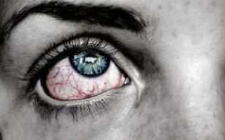 Что такое ретинопатия при сахарном диабете