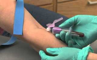 Как правильно сдавать кровь на сахар