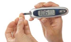 Анализ крови на сахар из вены