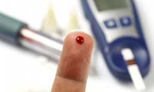 Сахар в крови от 21 до 21,9 ммоль/л что это значит