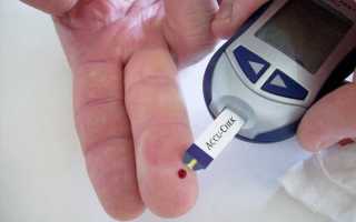 Сахар в крови от 23 до 23,9 ммоль/л что это значит