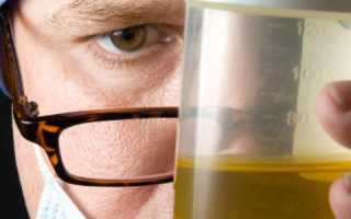 Результаты исследования диастазы мочи у взрослых при развитии панкреатита