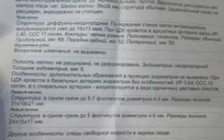В какие дни цикла лучше делать УЗИ малого таза?