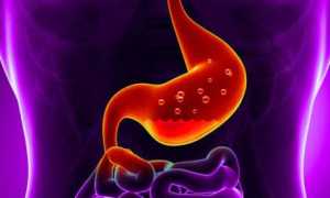 Гастрит при сахарном диабете: особенности терапии