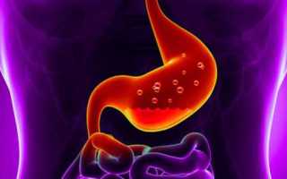 Гастрит при сахарном диабете: особенности терапии