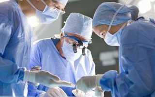 Показания и противопоказания к пересадке поджелудочной железы, методики проведения операции