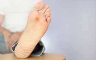 Синдром диабетической стопы уход и профилактика