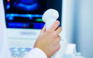 Ультразвуковое исследование при заболевании панкреатит