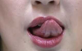 Жжение языка и верхней губы после орального секса