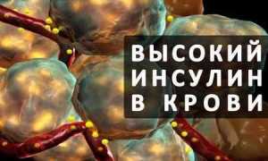 Как снизить уровень инсулина в крови народными и другими средствами
