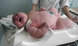 Диабетическая фетопатия: современные данные