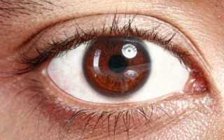 Диабетическая ретинопатия – причины, суть патологии, лечение