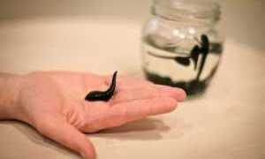 Можно ли ставить пиявки при сахарном диабете