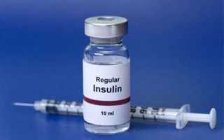 Инсулиновая резистентность: что это такое, признаки, анализ и как вылечить