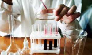 Как проводятся анализы на определение сахарного диабета