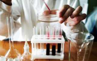 Как проводятся анализы на определение сахарного диабета