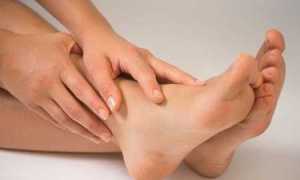 Признаки диабетической стопы на фото и как лечить синдром дома