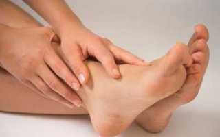 Признаки диабетической стопы на фото и как лечить синдром дома