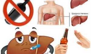 Цирроз печени от алкоголя