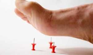 Диабетическая язва: что нужно знать об осложнении болезни