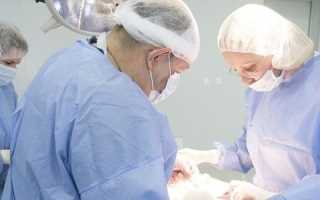 Методика проведения лапароскопии при панкреатите: показания и технология проведения