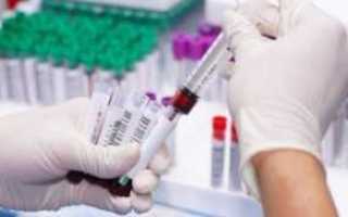 Нормальные значения сахара в плазме крови пониженные и повышенные результаты