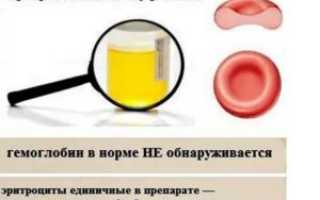 Эритроциты в моче у ребенка