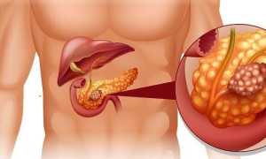 Особенности диффузных изменений поджелудочной железы
