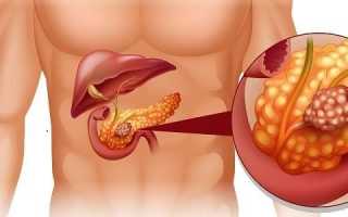 Особенности диффузных изменений поджелудочной железы