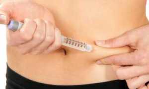 Сахарный диабет 1 типа: симптомы и лечение