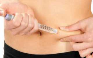 Сахарный диабет 1 типа: симптомы и лечение