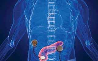 Что такое искусственная поджелудочная железа?